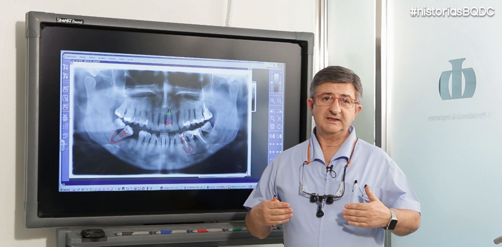 galvan-implantes-dentales